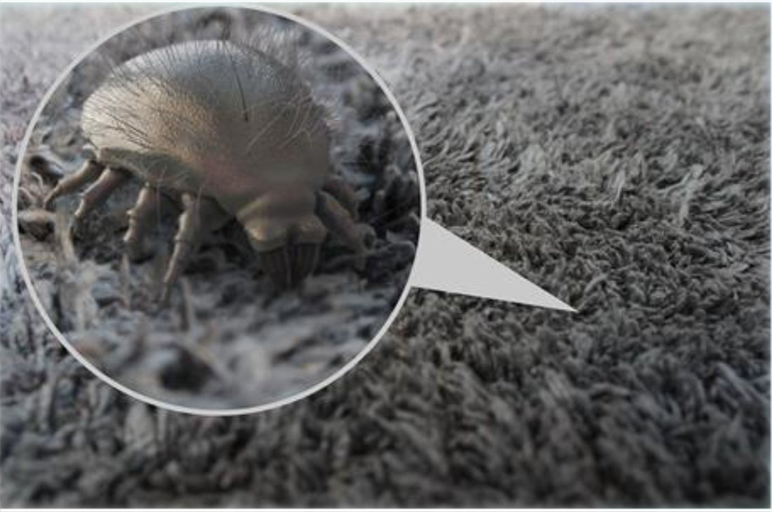 Dust Mites Allergies Symptoms, Causes, Treatments