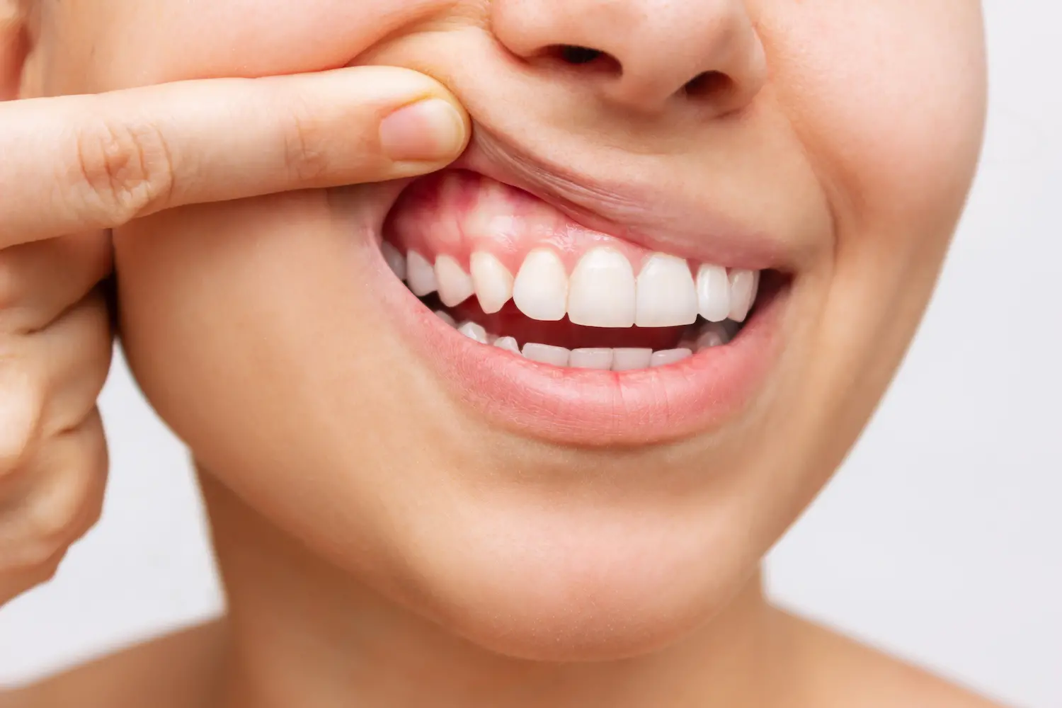 How to Determine Your Gum Health