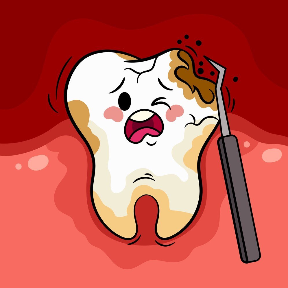 Is a Toothache a Sign of a Serious Dental Issue?
